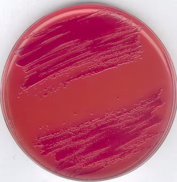 Merck GranuCult® prime CIN Agar (Cefsulodin, Irgasan, Novobiocin)
